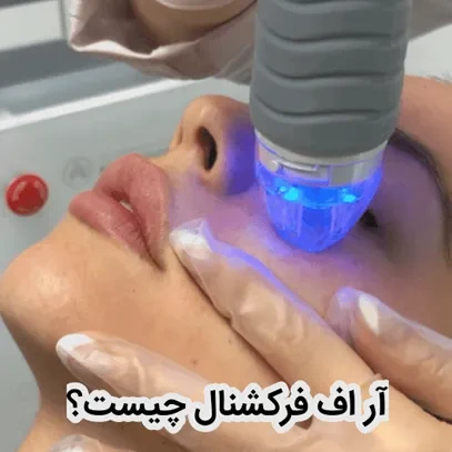 آر اف فرکشنال چیست؟ مزایا، معایب و مراقبت + هزینه